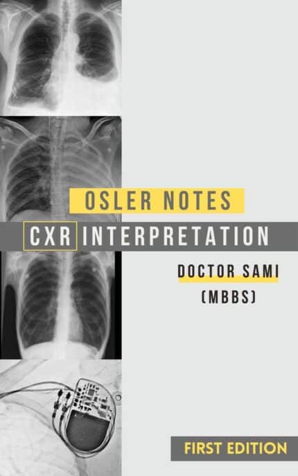 CXR Interpretation