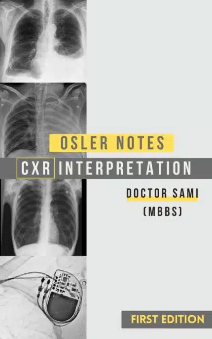 CXR Interpretation